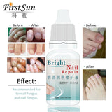 First Sun Nail Fungus Treatment