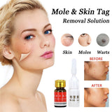 Dr. Issei Speckle Killer & Wart / Skin Tag Remover