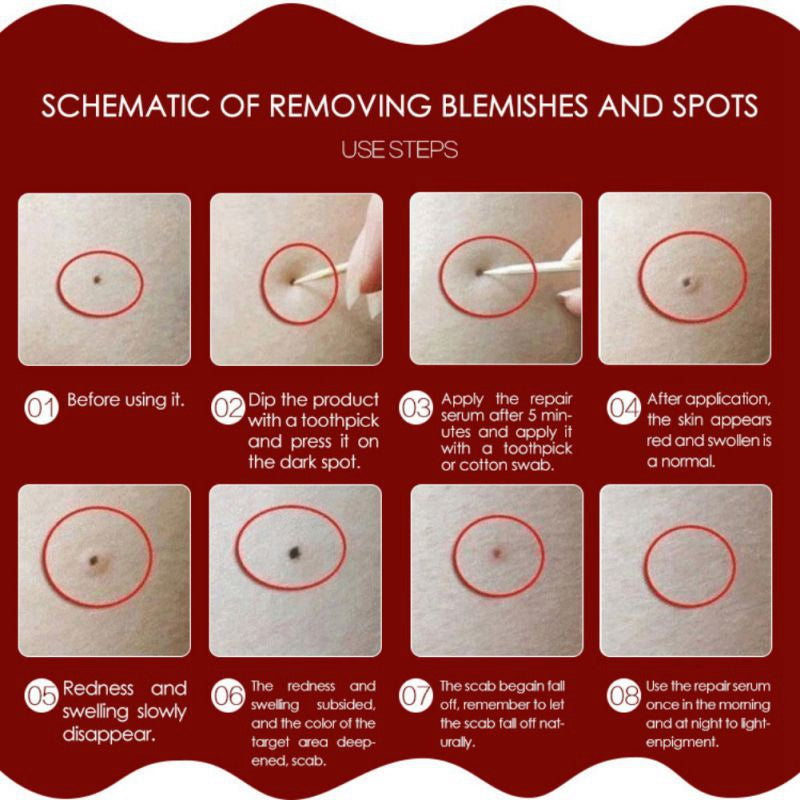 Dr. Issei Speckle Killer & Wart / Skin Tag Remover
